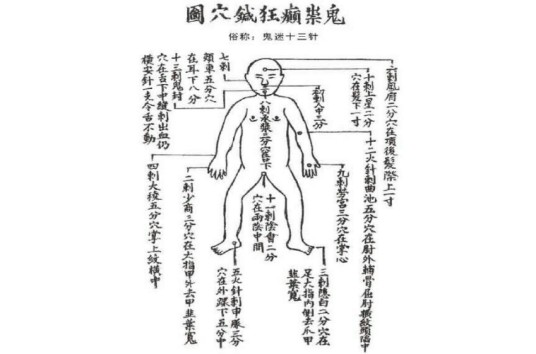 鬼门十三针（中医针法）
