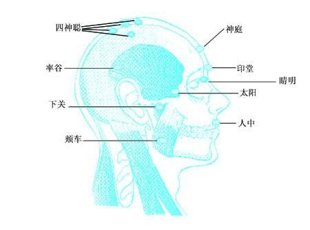 印堂（人体腧穴）