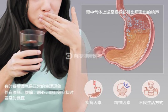 嗳气