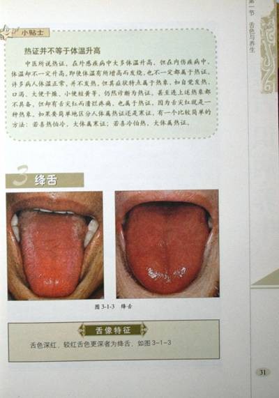 齿痕舌