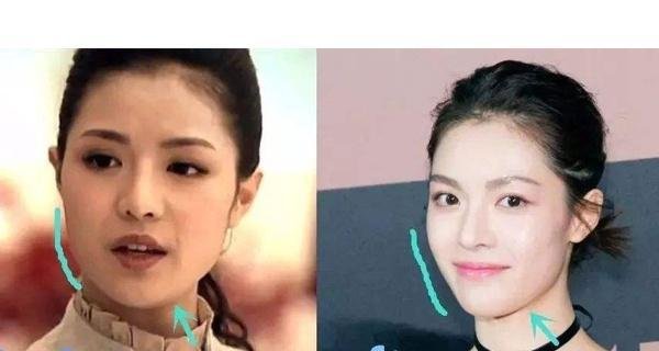 号称“高级脸”的钟楚曦今昔对比照判若两人，变脸过程堪称“最自然”