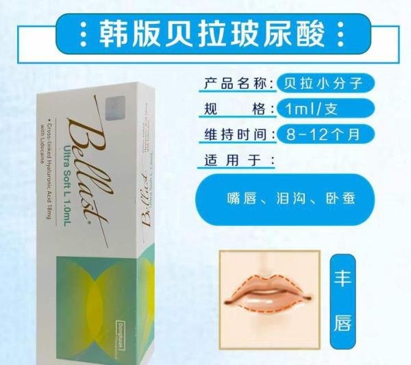 韩国贝拉玻尿酸介绍