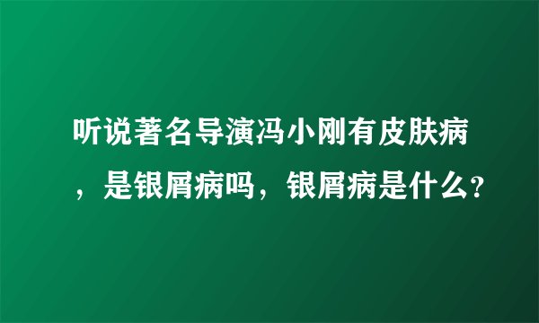 听说著名导演冯小刚有皮肤病，是银屑病吗，银屑病是什么？
