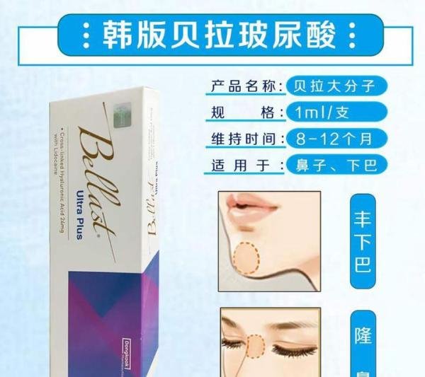 韩国贝拉玻尿酸介绍