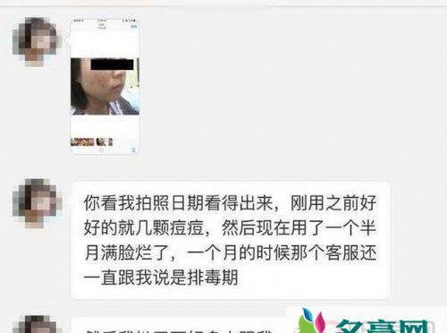 张庭护肤品遭投诉 顾客称致其烂脸