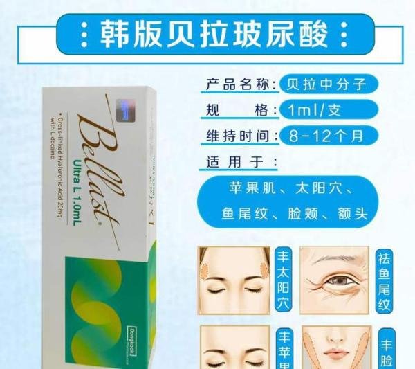 韩国贝拉玻尿酸介绍