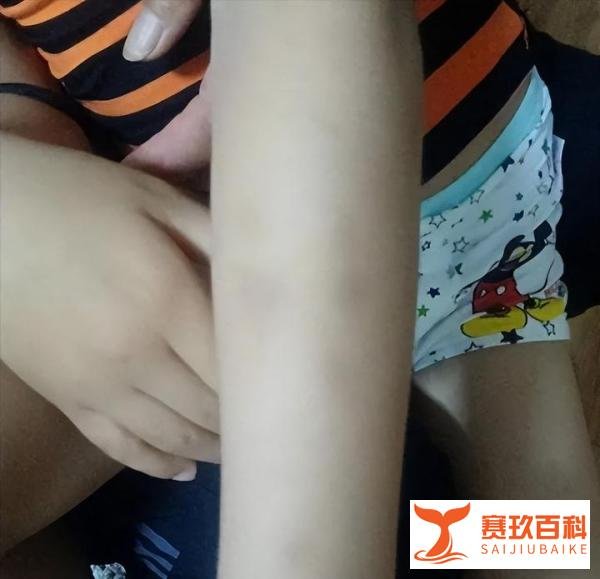 5岁男孩在幼儿园17天内几乎每天挨打,官方:涉事教师已被辞退!