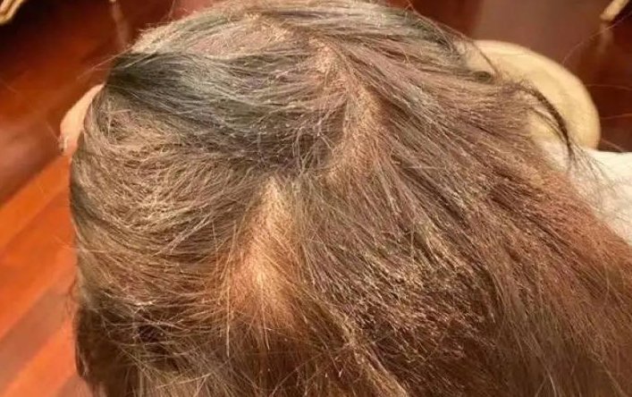 杭州一女生花1000元染发却像“狗啃”，她该如何维权？