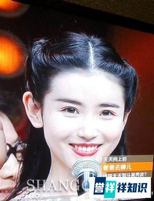 过辛气网红张苑整容心酸史
