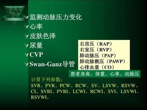 svi是什么？