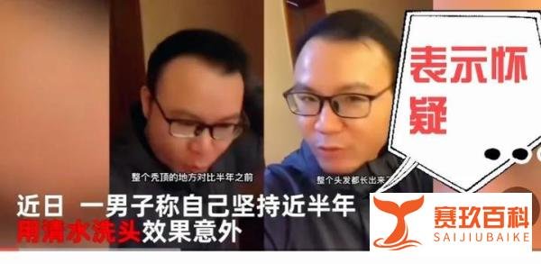 不用洗发水变满头黑发是真是假 治疗脱发最有效的药物