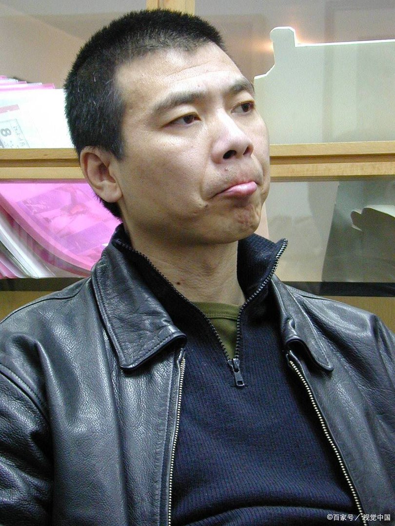 冯小刚的脸怎么治好的