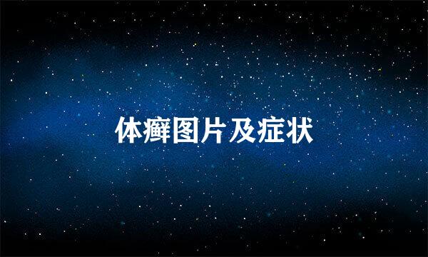 体癣图片及症状