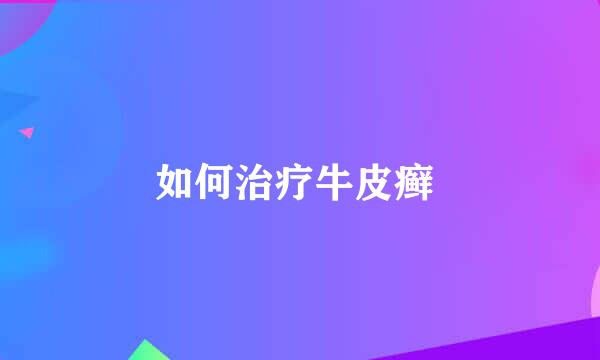 如何治疗牛皮癣 