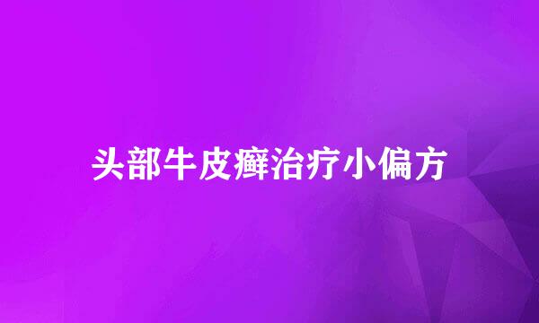 头部牛皮癣治疗小偏方